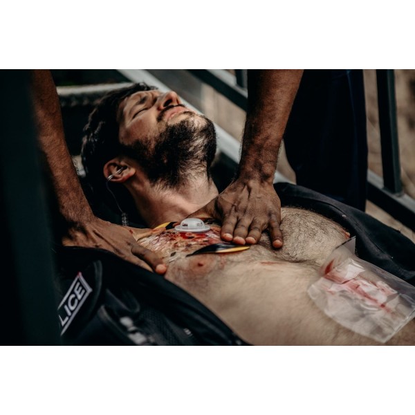 Окклюзионная наклейка SAM Medical Chest seal комбинированная - 3574146 Окклюзионная наклейка SAM Medical Chest seal комбинированная - 3574146